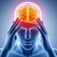Migraine image 2