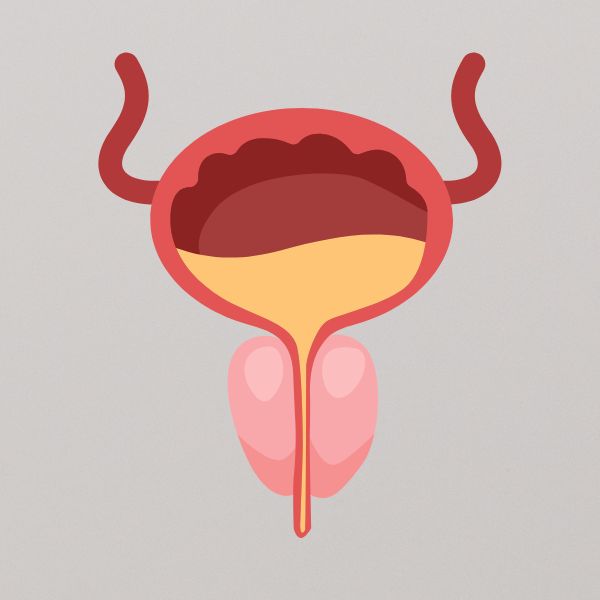 Prostatitis image 1